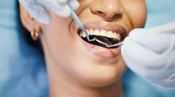 Trusted South San Francisco, CA Dental Services Experts